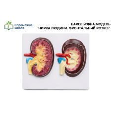 Барельєфна модель "Нирка людини. Фронтальний розріз." 40х40 см